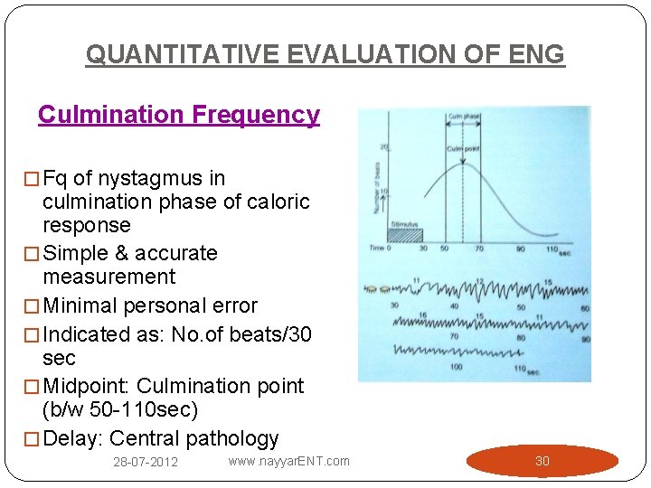 QUANTITATIVE EVALUATION OF ENG Culmination Frequency � Fq of nystagmus in culmination phase of