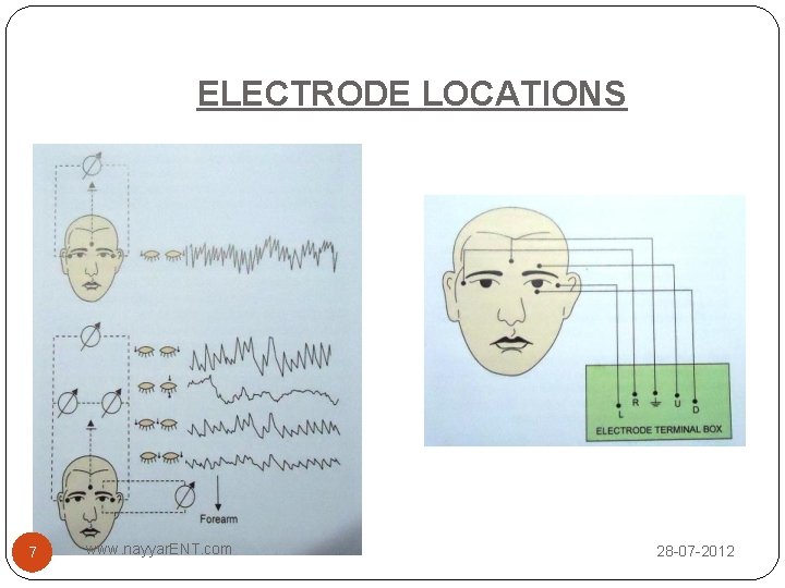 ELECTRODE LOCATIONS 7 www. nayyar. ENT. com 28 -07 -2012 