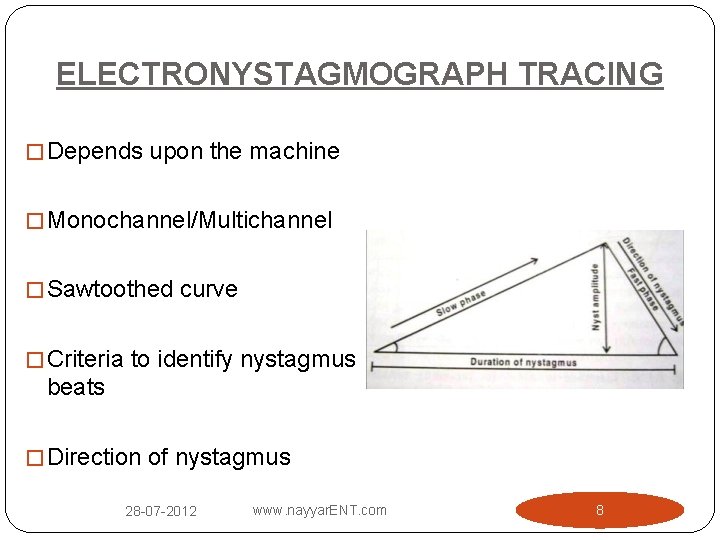 ELECTRONYSTAGMOGRAPH TRACING � Depends upon the machine � Monochannel/Multichannel � Sawtoothed curve � Criteria