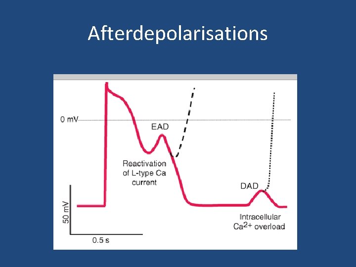 Afterdepolarisations 