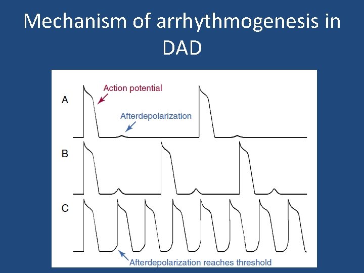 Mechanism of arrhythmogenesis in DAD 