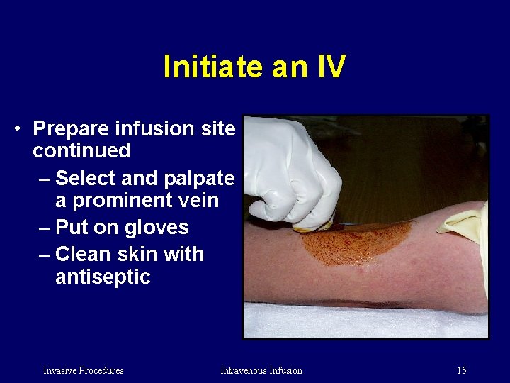 Initiate an IV • Prepare infusion site continued – Select and palpate a prominent