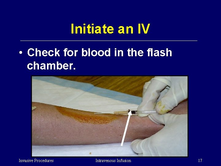 Initiate an IV • Check for blood in the flash chamber. Invasive Procedures Intravenous