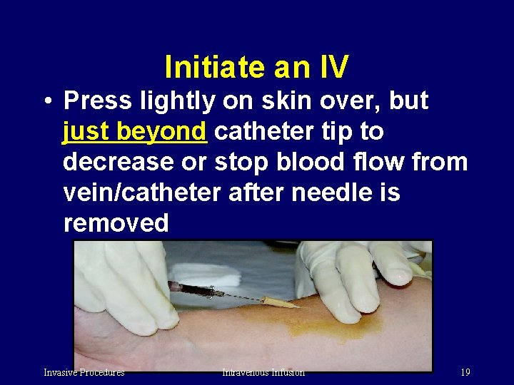 Initiate an IV • Press lightly on skin over, but just beyond catheter tip