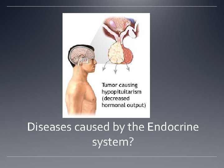 Diseases caused by the Endocrine system? Diseases caused by the Endocrine system?