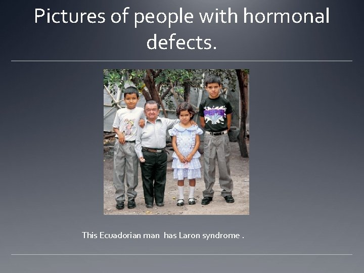 Pictures of people with hormonal defects. This Ecuadorian man has Laron syndrome. Pictures of people with hormonal defects. This Ecuadorian man has Laron syndrome.