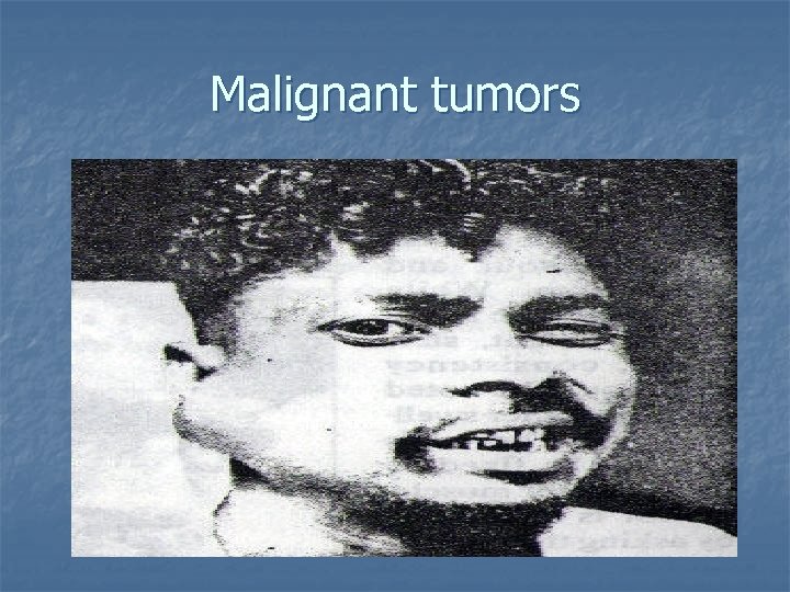 Malignant tumors 