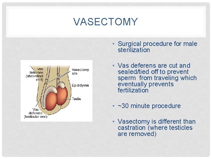 VASECTOMY • Surgical procedure for male sterilization • Vas deferens are cut and sealed/tied