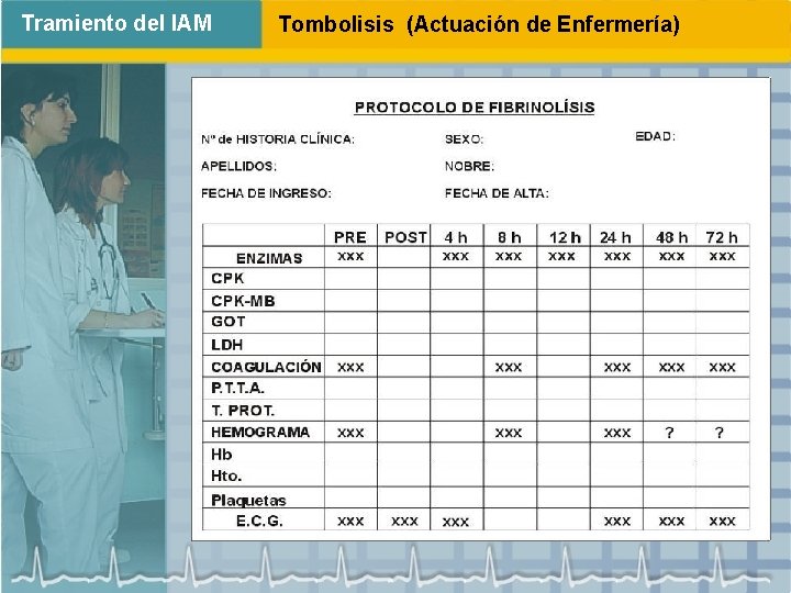 Tramiento del IAM Tombolisis (Actuación de Enfermería) • Realizar: - Controles analíticos - Controles