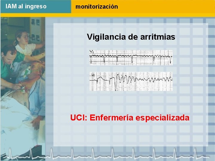 IAM al ingreso monitorización Vigilancia de arritmias UCI: Enfermería especializada 