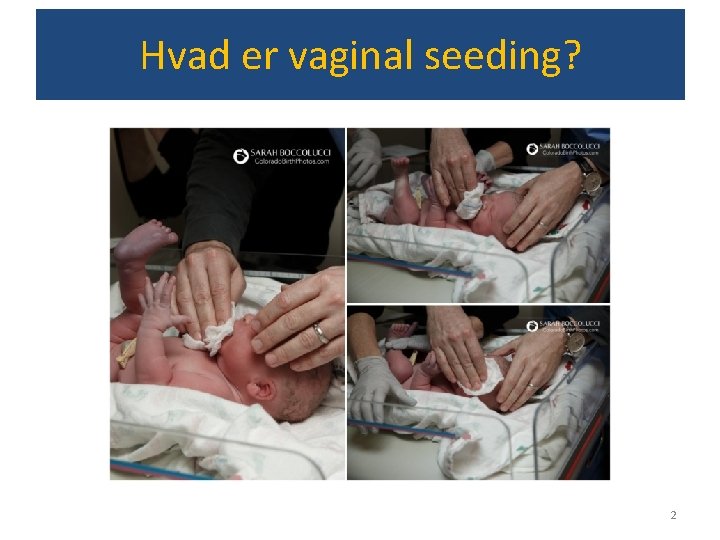 Hvad er vaginal seeding? 2 