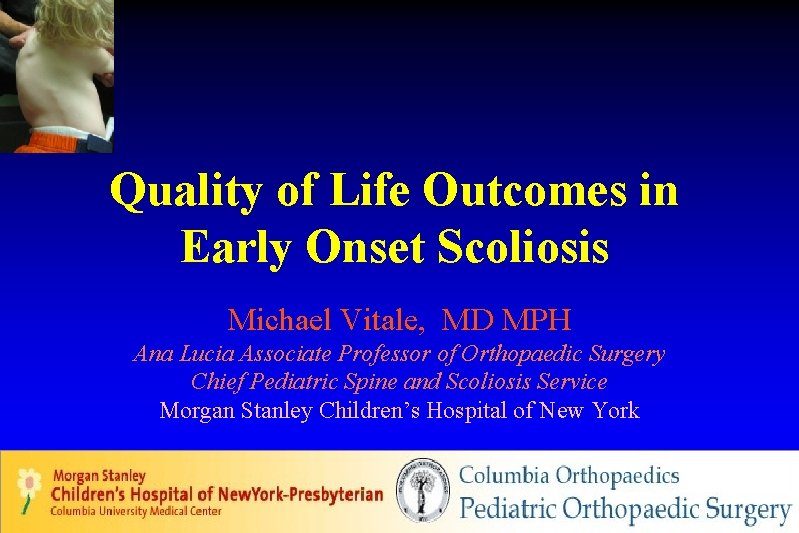 Quality of Life Outcomes in Early Onset Scoliosis Michael Vitale, MD MPH Ana Lucia