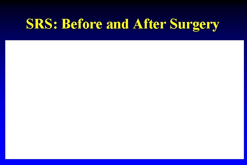 SRS: Before and After Surgery 