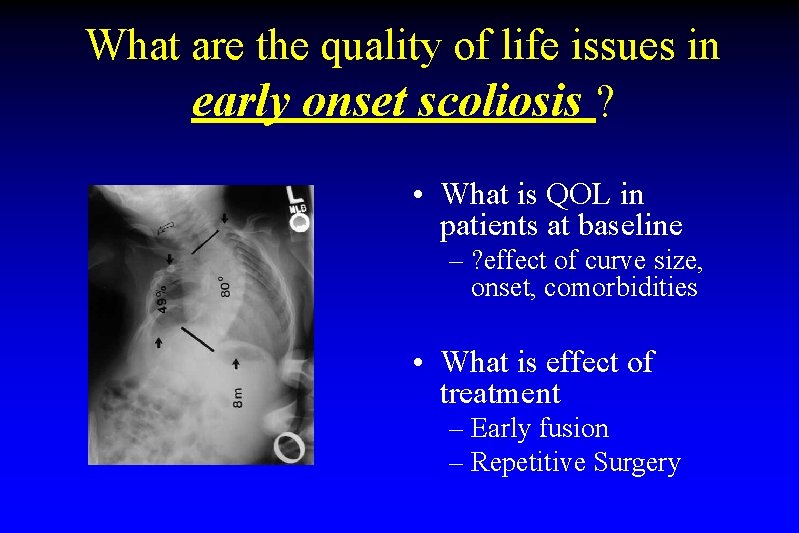 What are the quality of life issues in early onset scoliosis ? • What