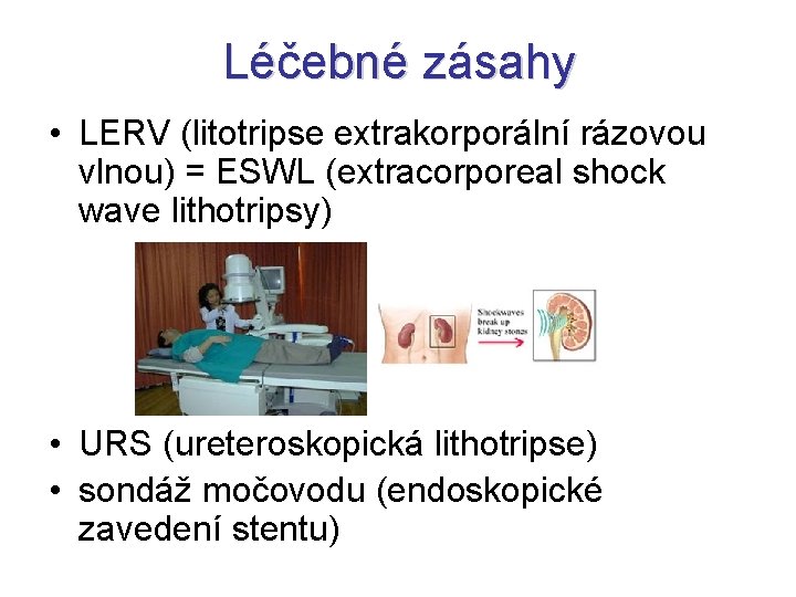 Léčebné zásahy • LERV (litotripse extrakorporální rázovou vlnou) = ESWL (extracorporeal shock wave lithotripsy)