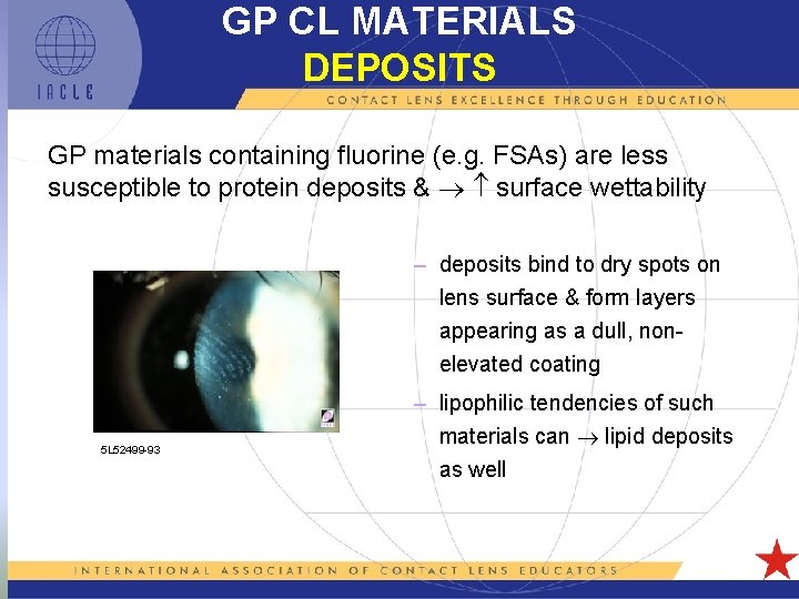 GP CL MATERIALS DEPOSITS GP materials containing fluorine (e. g. FSAs) are less susceptible