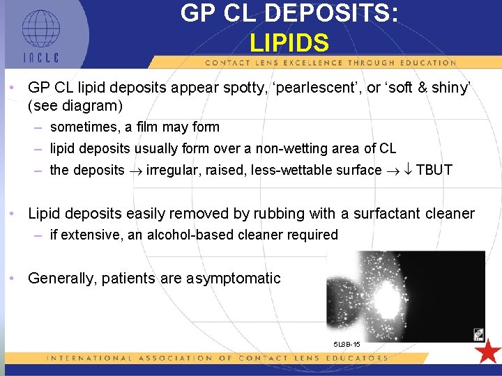 GP CL DEPOSITS: LIPIDS • GP CL lipid deposits appear spotty, ‘pearlescent’, or ‘soft