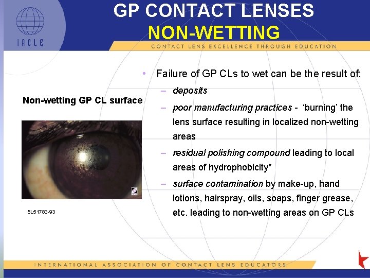 GP CONTACT LENSES NON-WETTING • Failure of GP CLs to wet can be the