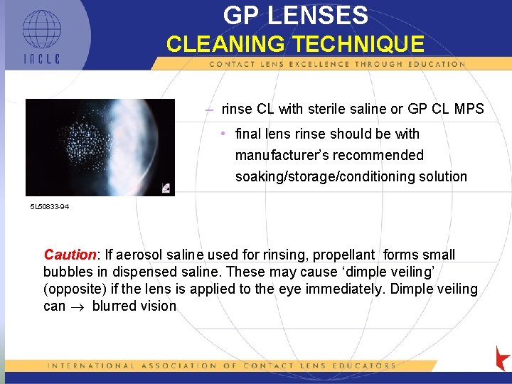 GP LENSES CLEANING TECHNIQUE – rinse CL with sterile saline or GP CL MPS