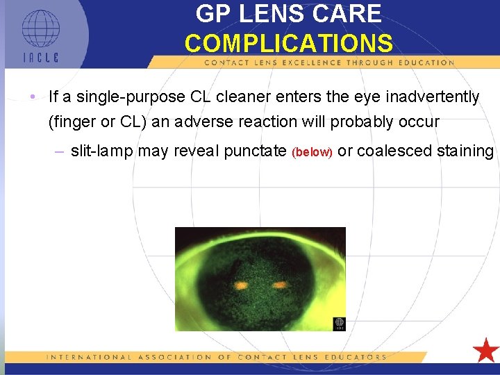 GP LENS CARE COMPLICATIONS • If a single-purpose CL cleaner enters the eye inadvertently