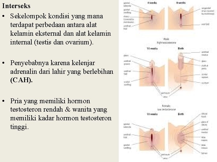 Interseks • Sekelompok kondisi yang mana terdapat perbedaan antara alat kelamin eksternal dan alat