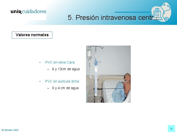 5. Presión intravenosa central Valores normales • PVC en vena Cava: – 6 y