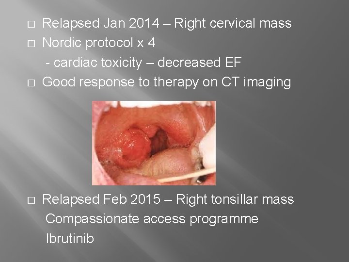 � � Relapsed Jan 2014 – Right cervical mass Nordic protocol x 4 -