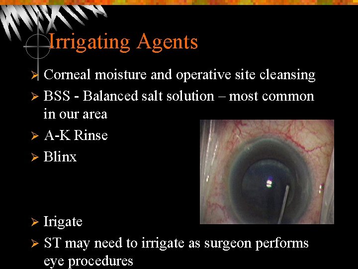 Irrigating Agents Corneal moisture and operative site cleansing Ø BSS - Balanced salt solution