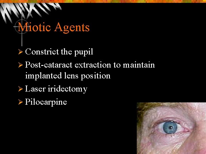 Miotic Agents Ø Constrict the pupil Ø Post-cataract extraction to maintain implanted lens position