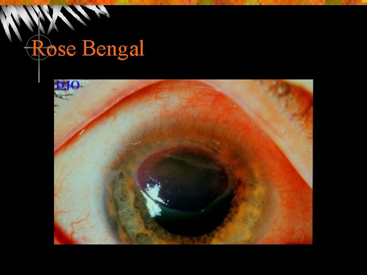 Rose Bengal 