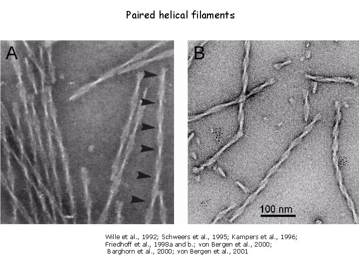 Paired helical filaments Wille et al. , 1992; Schweers et al. , 1995; Kampers