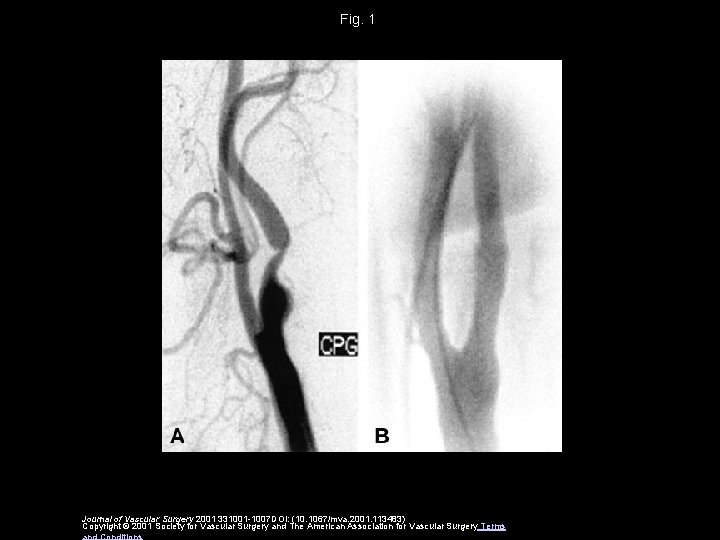 Fig. 1 Journal of Vascular Surgery 2001 331001 -1007 DOI: (10. 1067/mva. 2001. 113483)