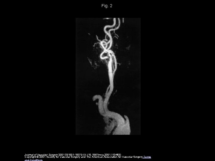 Fig. 2 Journal of Vascular Surgery 2001 331001 -1007 DOI: (10. 1067/mva. 2001. 113483)