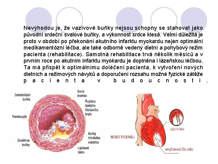 Nevýhodou je, že vazivové buňky nejsou schopny se stahovat jako původní srdeční svalové buňky,