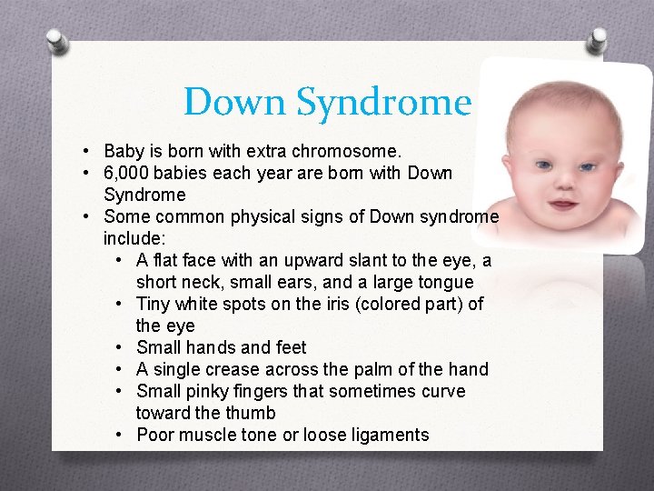 Down Syndrome • Baby is born with extra chromosome. • 6, 000 babies each