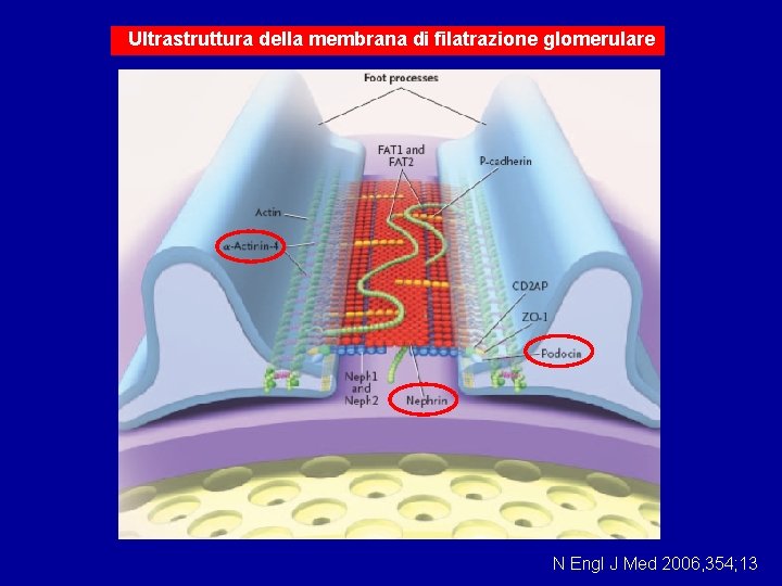 Ultrastruttura della membrana di filatrazione glomerulare N Engl J Med 2006, 354; 13 