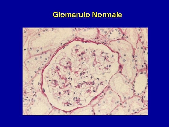 Glomerulo Normale 