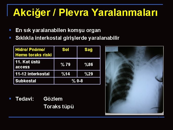 Akciğer / Plevra Yaralanmaları § En sık yaralanabilen komşu organ § Sıklıkla interkostal girişlerde
