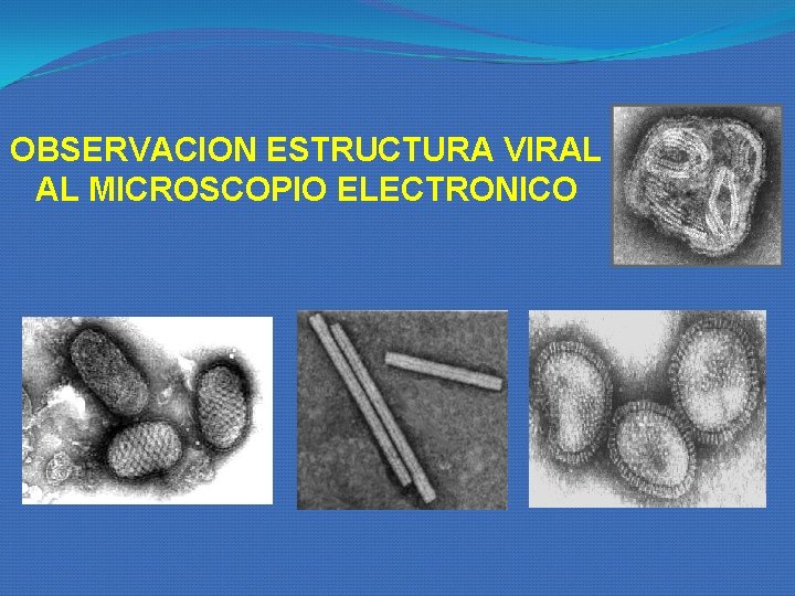 OBSERVACION ESTRUCTURA VIRAL AL MICROSCOPIO ELECTRONICO OBSERVACION ESTRUCTURA VIRAL AL MICROSCOPIO ELECTRONICO
