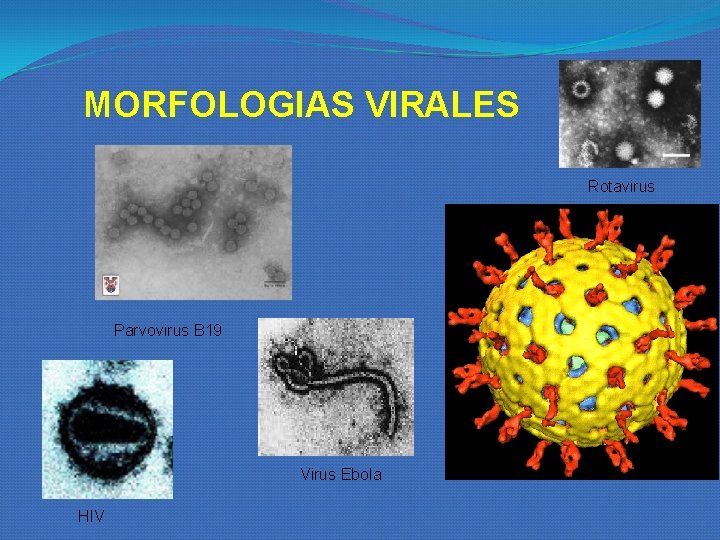 MORFOLOGIAS VIRALES Rotavirus Parvovirus B 19 Virus Ebola HIV MORFOLOGIAS VIRALES Rotavirus Parvovirus B 19 Virus Ebola HIV