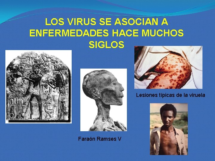 LOS VIRUS SE ASOCIAN A ENFERMEDADES HACE MUCHOS SIGLOS Lesiones típicas de la viruela LOS VIRUS SE ASOCIAN A ENFERMEDADES HACE MUCHOS SIGLOS Lesiones típicas de la viruela