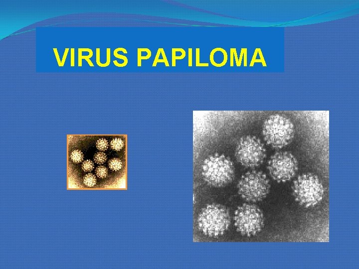 VIRUS PAPILOMA VIRUS PAPILOMA