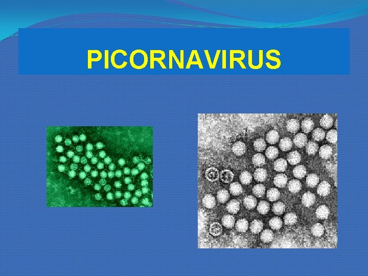 PICORNAVIRUS PICORNAVIRUS