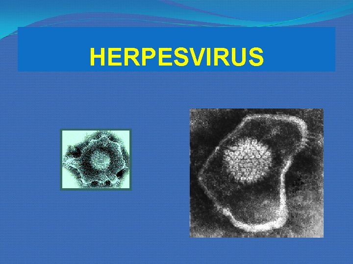 HERPESVIRUS HERPESVIRUS