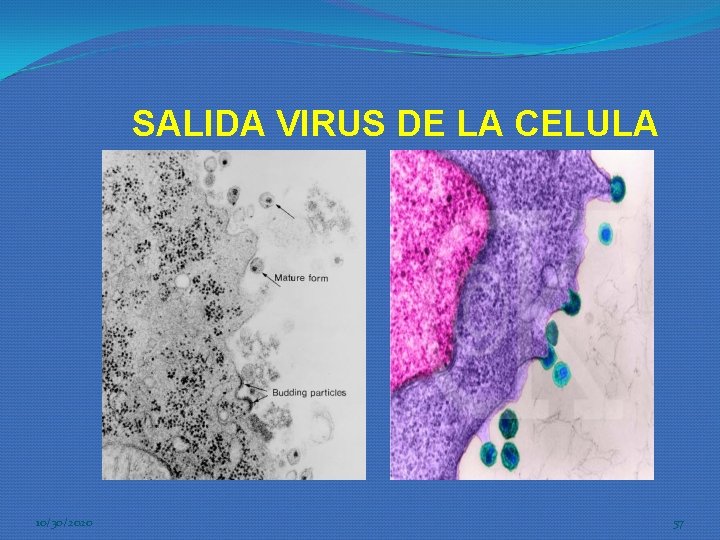 SALIDA VIRUS DE LA CELULA 10/30/2020 57 SALIDA VIRUS DE LA CELULA 10/30/2020 57