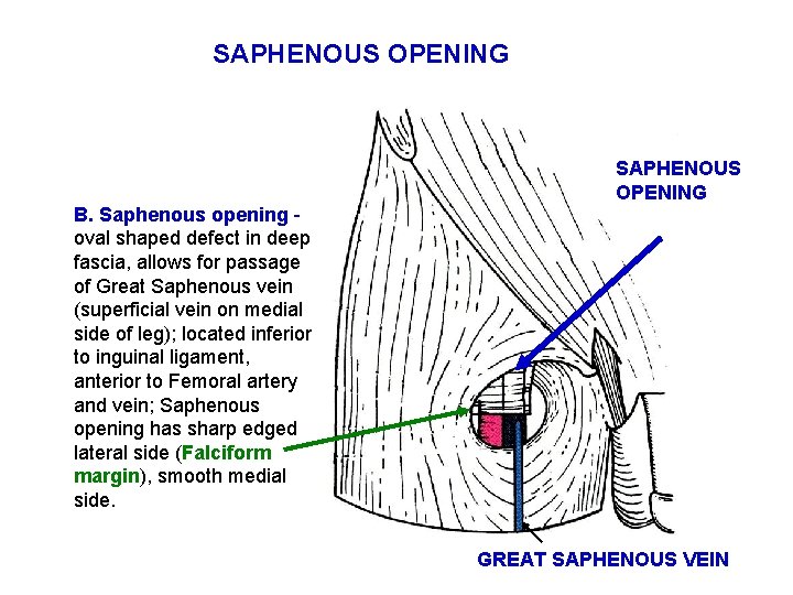 SAPHENOUS OPENING B. Saphenous opening oval shaped defect in deep fascia, allows for passage