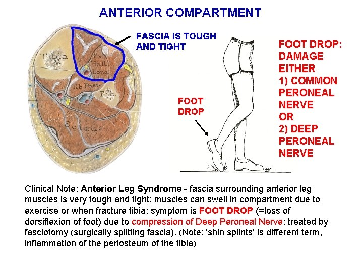 ANTERIOR COMPARTMENT FASCIA IS TOUGH AND TIGHT FOOT DROP: DAMAGE EITHER 1) COMMON PERONEAL