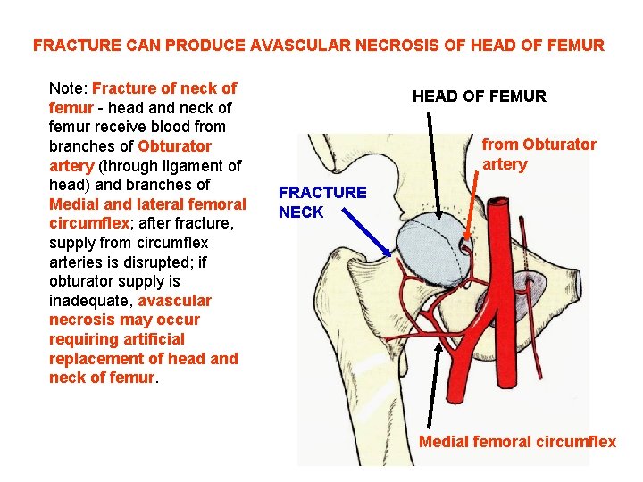 FRACTURE CAN PRODUCE AVASCULAR NECROSIS OF HEAD OF FEMUR Note: Fracture of neck of