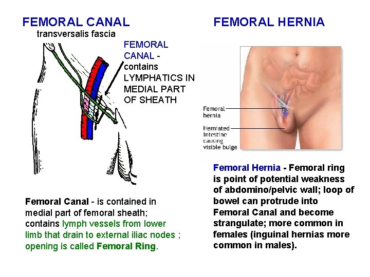 FEMORAL CANAL transversalis fascia FEMORAL HERNIA FEMORAL CANAL contains LYMPHATICS IN MEDIAL PART OF