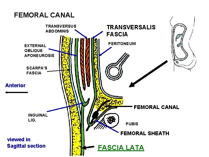 FEMORAL CANAL TRANSVERSUS ABDOMINIS EXTERNAL OBLIQUE APONEUROSIS TRANSVERSALIS FASCIA PERITONEUM SCARPA'S FASCIA Anterior FEMORAL